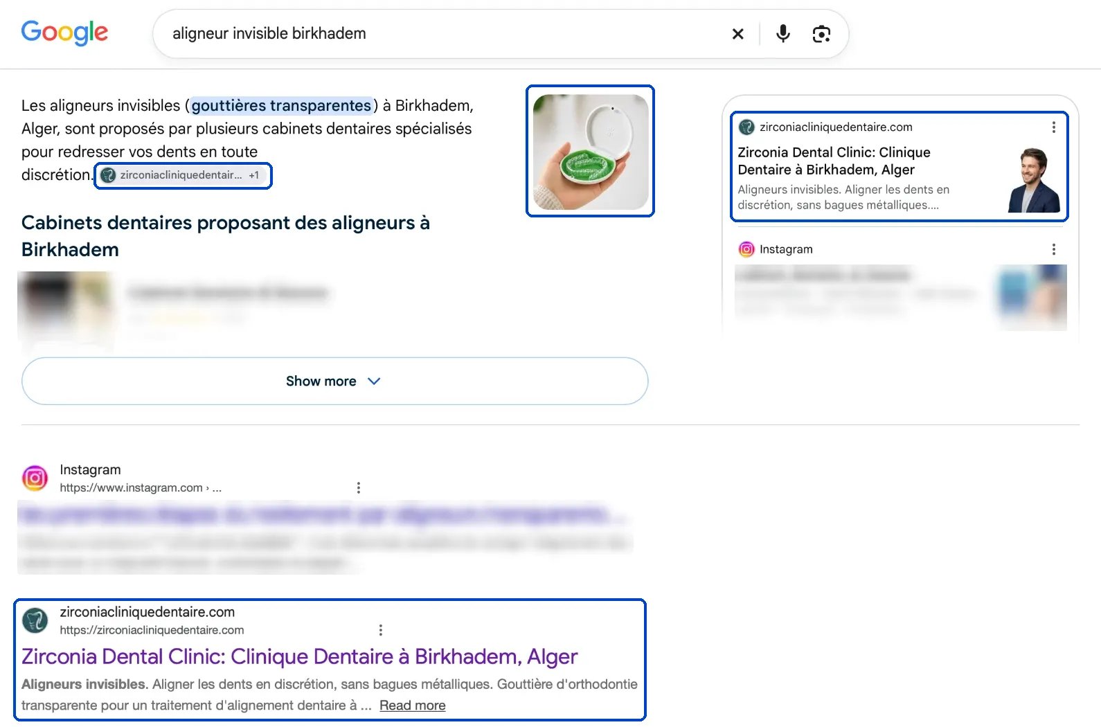 Résultats Google pour « aligneur invisible birkhadem ». Zirconia Dental Clinic, encadrée, apparaît quatre fois : source citée par l'AI Overview, photo reprise par l'AI Overview, première source du panneau de droite, puis résultat naturel. Les autres cliniques sont floutées